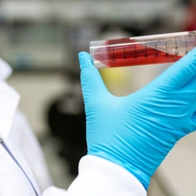 scientist holding a test tube