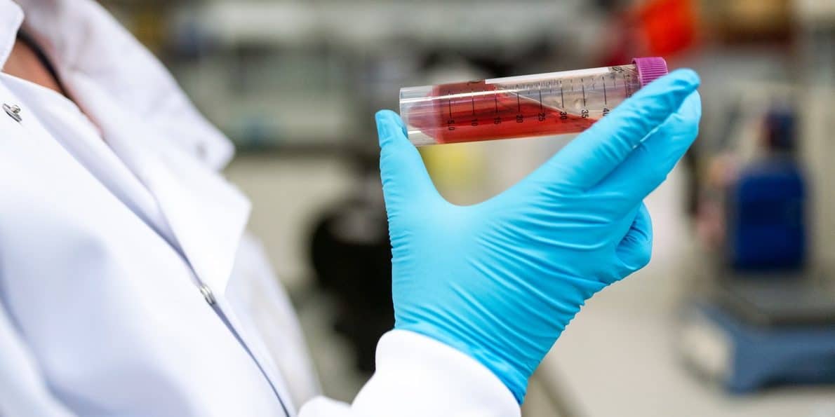 scientist holding a test tube